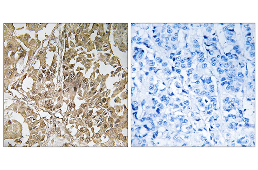 Immunohistochemistry - Anti-BUB1 Antibody (C10115) - Antibodies.com