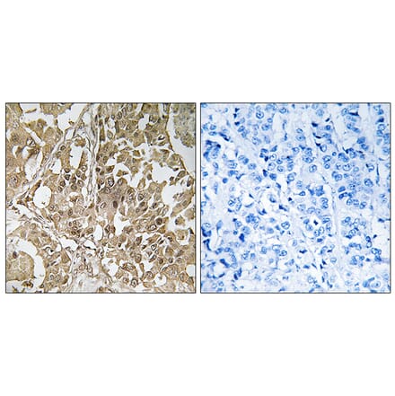 Immunohistochemistry - Anti-BUB1 Antibody (C10115) - Antibodies.com