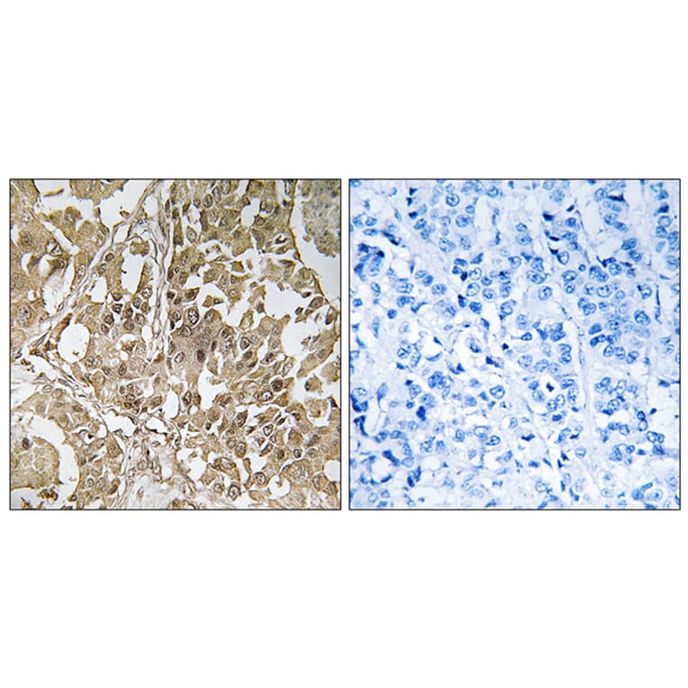 Immunohistochemistry - Anti-BUB1 Antibody (C10115) - Antibodies.com