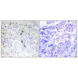 Immunohistochemistry - Anti-BATF Antibody (C11122) - Antibodies.com