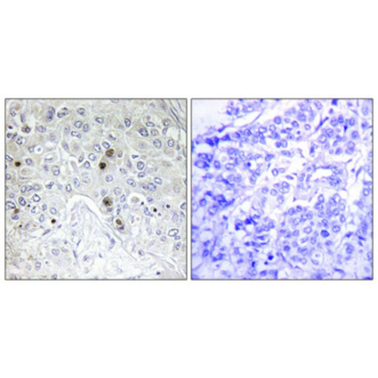 Immunohistochemistry - Anti-BATF Antibody (C11122) - Antibodies.com