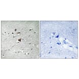 Immunohistochemistry - Anti-APC1 Antibody (B8242) - Antibodies.com