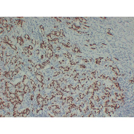 Immunohistochemistry - Anti-SOX9 Antibody (V0126) - Antibodies.com