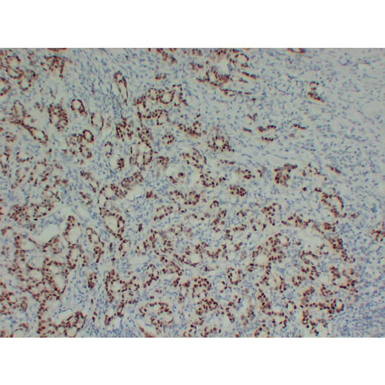 Immunohistochemistry - Anti-SOX9 Antibody (V0126) - Antibodies.com