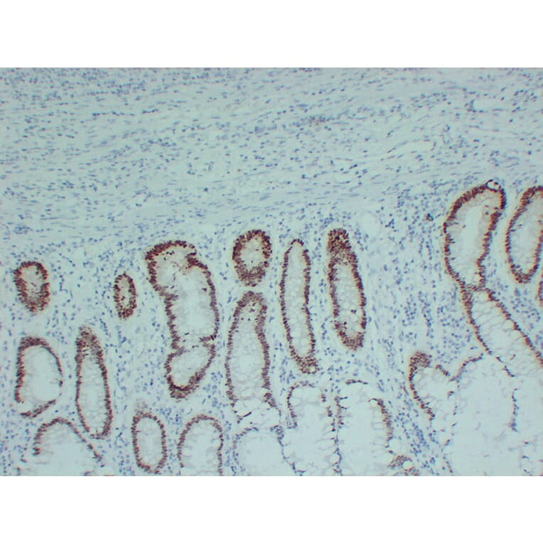 Immunohistochemistry - Anti-SOX9 Antibody (V0126) - Antibodies.com