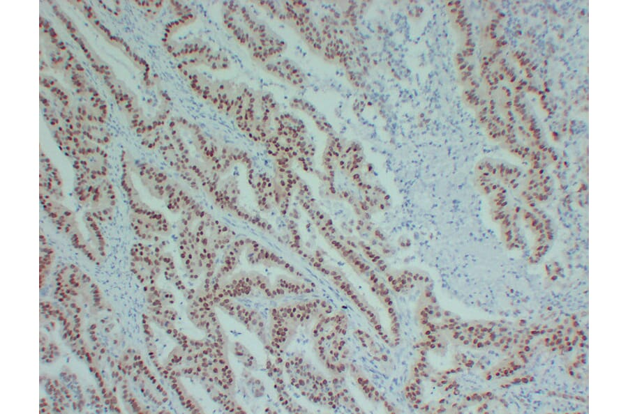 Immunohistochemistry - Anti-SOX9 Antibody (V0126) - Antibodies.com