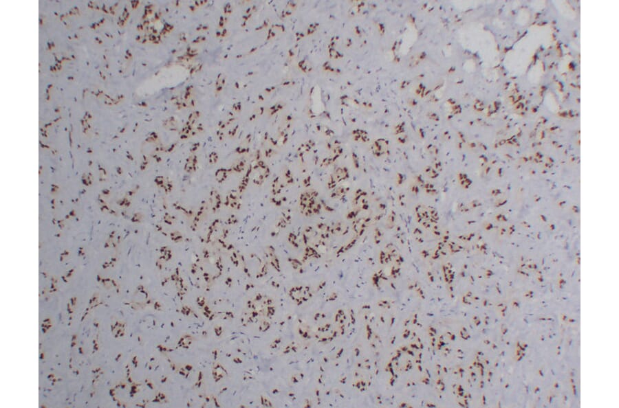 Immunohistochemistry - Anti-FLI1 Antibody (V0072) - Antibodies.com