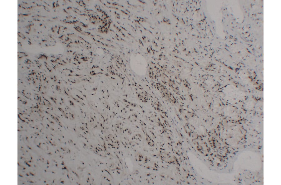 Immunohistochemistry - Anti-FLI1 Antibody (V0072) - Antibodies.com