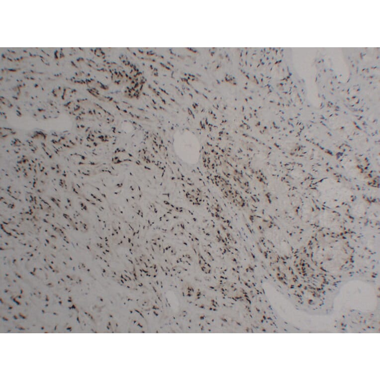 Immunohistochemistry - Anti-FLI1 Antibody (V0072) - Antibodies.com