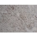 Immunohistochemistry - Anti-FLI1 Antibody (V0072) - Antibodies.com