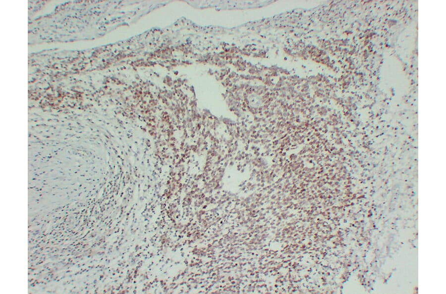 Immunohistochemistry - Anti-FLI1 Antibody (V0072) - Antibodies.com