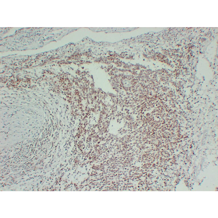 Immunohistochemistry - Anti-FLI1 Antibody (V0072) - Antibodies.com
