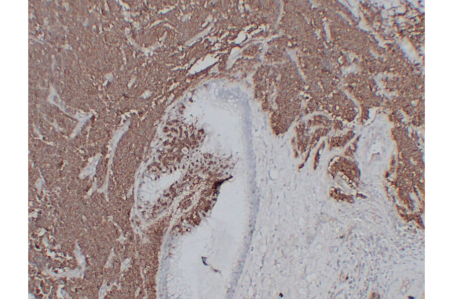 Immunohistochemistry - Anti-CD56 Antibody (V0032) - Antibodies.com