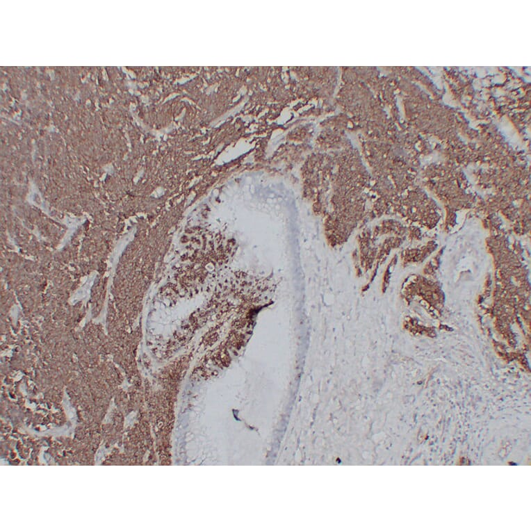 Immunohistochemistry - Anti-CD56 Antibody (V0032) - Antibodies.com