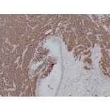 Immunohistochemistry - Anti-CD56 Antibody (V0032) - Antibodies.com