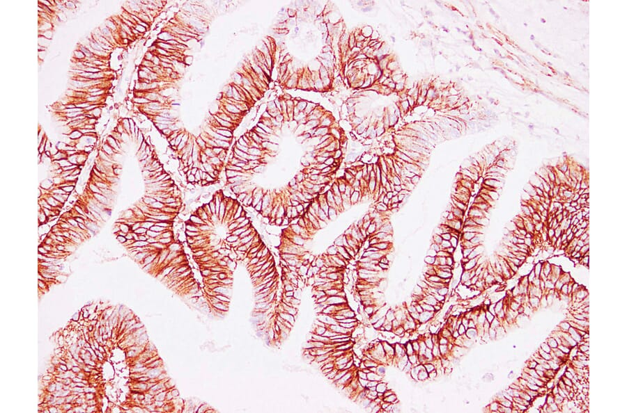 Immunohistochemistry - Anti-CD44 Antibody (V0028) - Antibodies.com