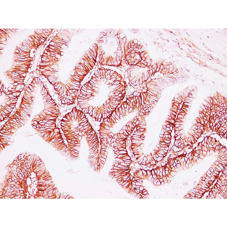 Immunohistochemistry - Anti-CD44 Antibody (V0028) - Antibodies.com