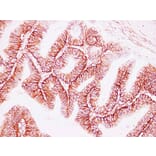 Immunohistochemistry - Anti-CD44 Antibody (V0028) - Antibodies.com