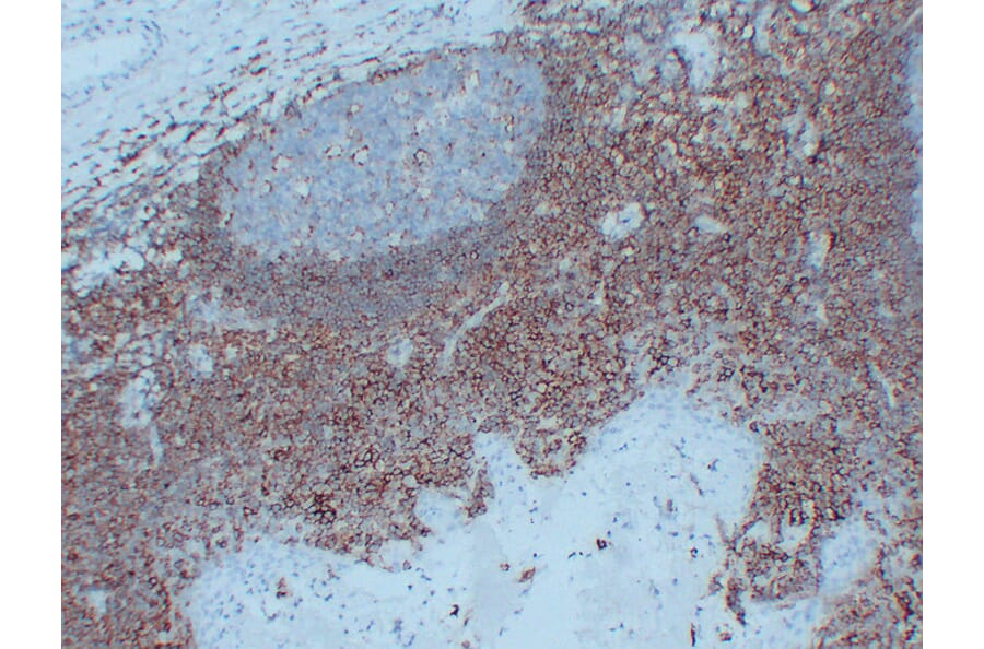 Immunohistochemistry - Anti-CD44 Antibody (V0028) - Antibodies.com
