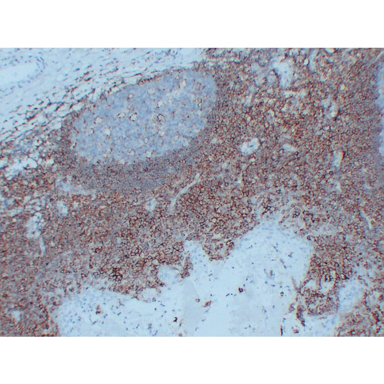 Immunohistochemistry - Anti-CD44 Antibody (V0028) - Antibodies.com