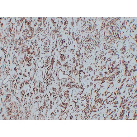 Immunohistochemistry - Anti-CD31 Antibody (V0022) - Antibodies.com