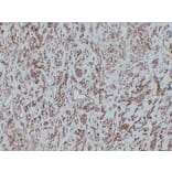 Immunohistochemistry - Anti-CD31 Antibody (V0022) - Antibodies.com
