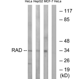 Western Blot - Anti-RAD Antibody (C16022) - Antibodies.com