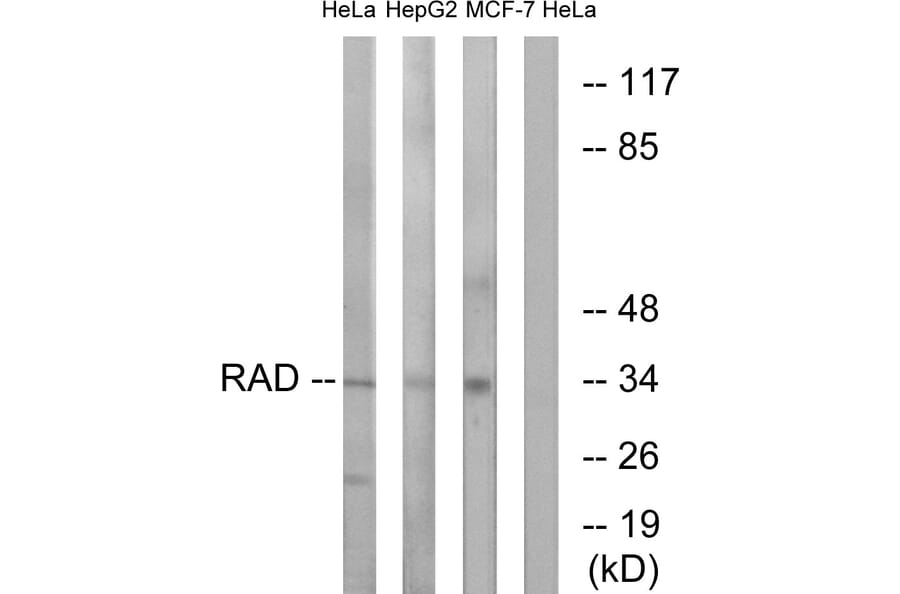 Western Blot - Anti-RAD Antibody (C16022) - Antibodies.com
