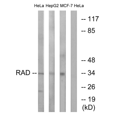 Western Blot - Anti-RAD Antibody (C16022) - Antibodies.com