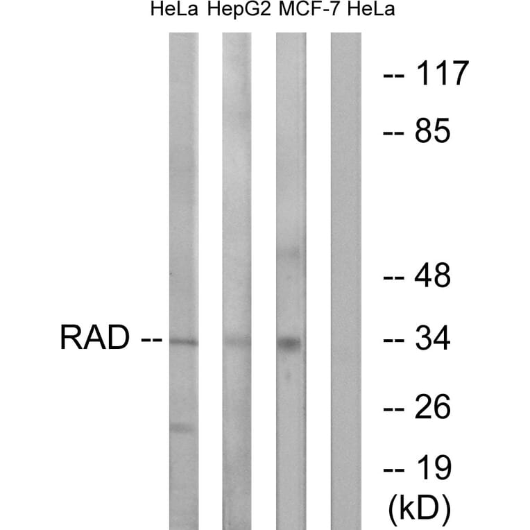 Western Blot - Anti-RAD Antibody (C16022) - Antibodies.com