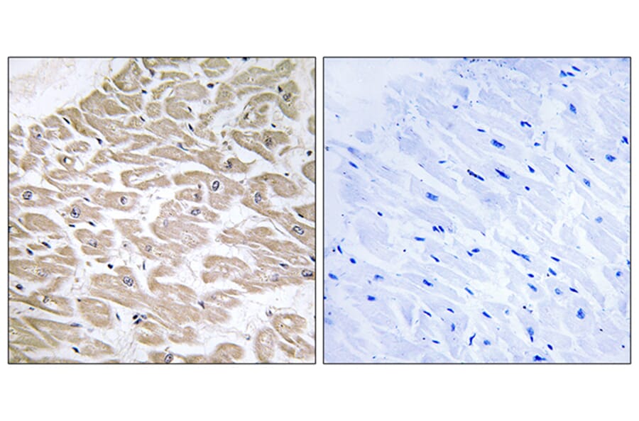 Immunohistochemistry - Anti-RAD Antibody (C16022) - Antibodies.com