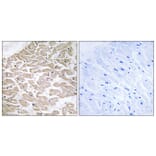 Immunohistochemistry - Anti-RAD Antibody (C16022) - Antibodies.com