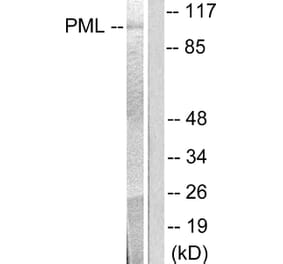 Western Blot - Anti-PML Antibody (C0305) - Antibodies.com