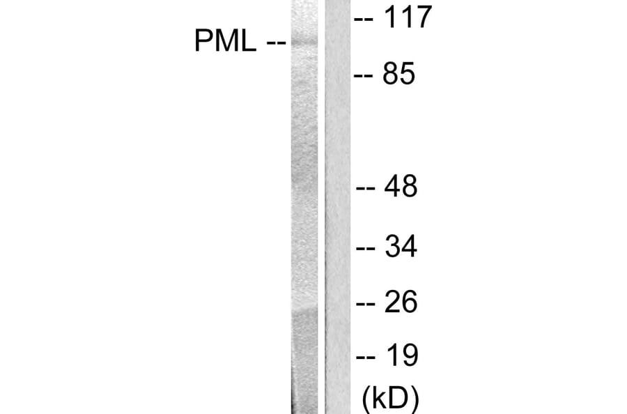 Western Blot - Anti-PML Antibody (C0305) - Antibodies.com