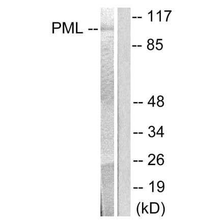 Western Blot - Anti-PML Antibody (C0305) - Antibodies.com