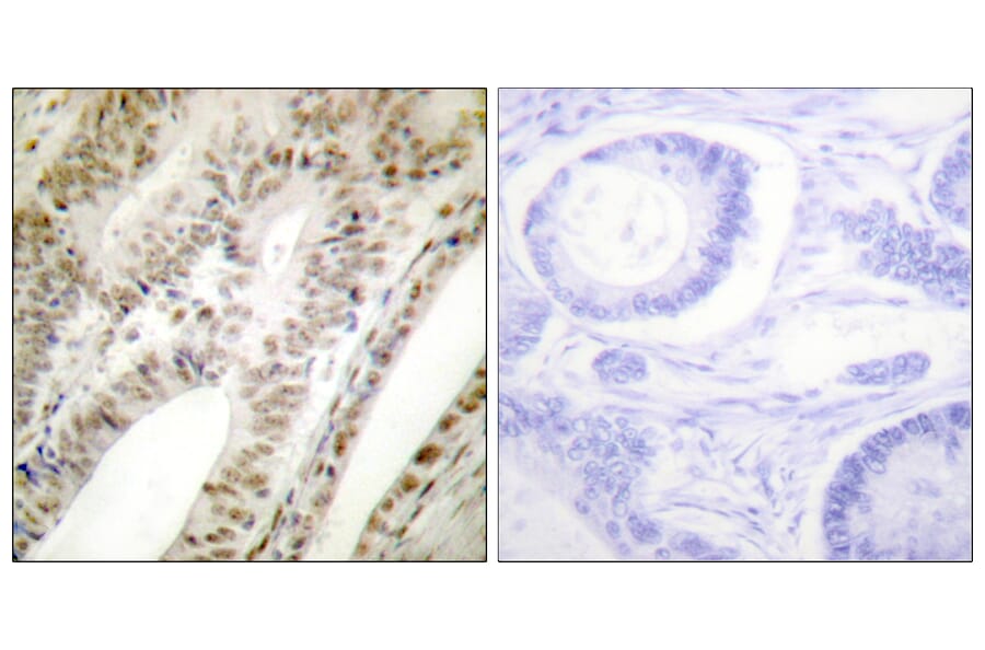 Immunohistochemistry - Anti-PML Antibody (C0305) - Antibodies.com