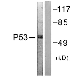 Western Blot - Anti-p53 Antibody (B0530) - Antibodies.com