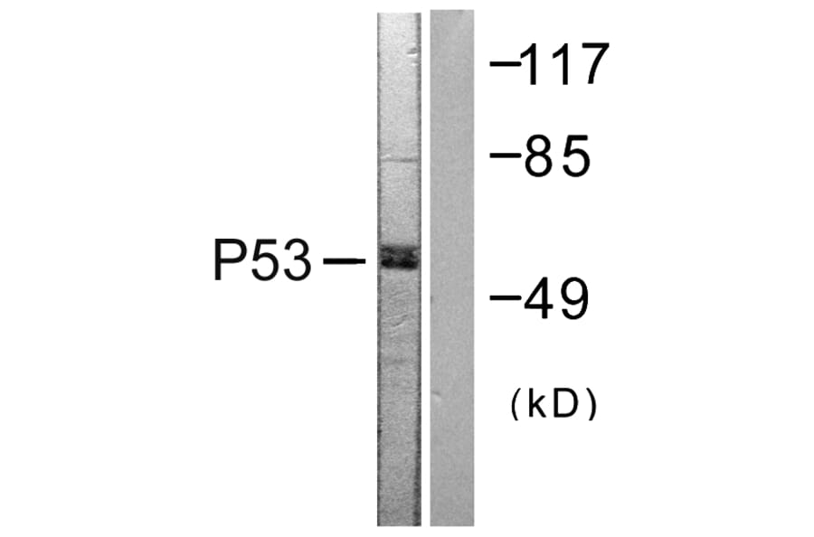Western Blot - Anti-p53 Antibody (B0530) - Antibodies.com