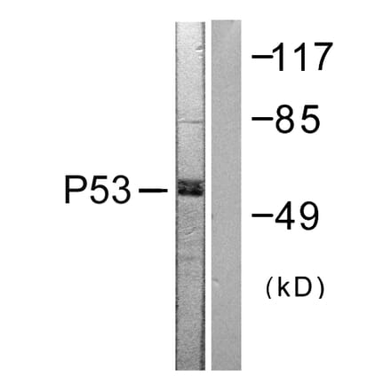 Western Blot - Anti-p53 Antibody (B0530) - Antibodies.com