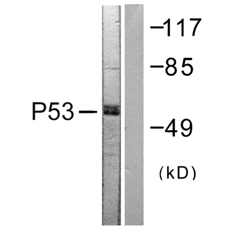 Western Blot - Anti-p53 Antibody (B0530) - Antibodies.com