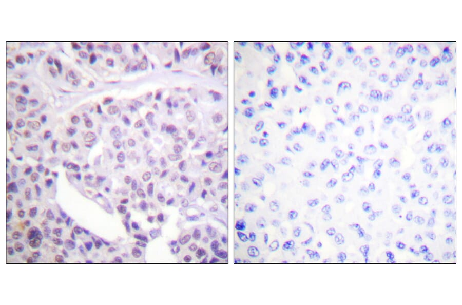 Immunohistochemistry - Anti-p53 Antibody (B0530) - Antibodies.com