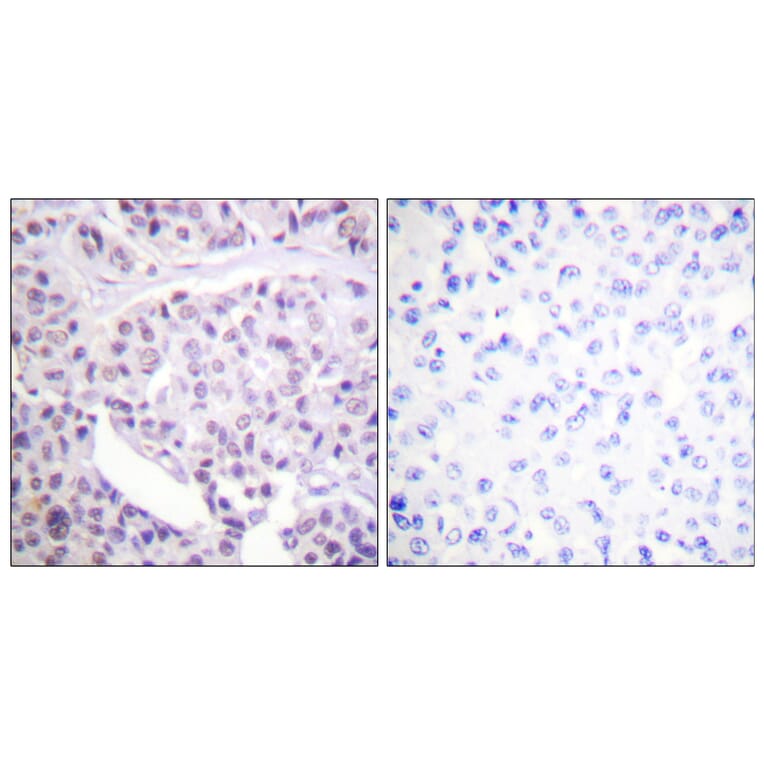 Immunohistochemistry - Anti-p53 Antibody (B0530) - Antibodies.com