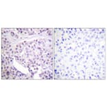 Immunohistochemistry - Anti-p53 Antibody (B0530) - Antibodies.com