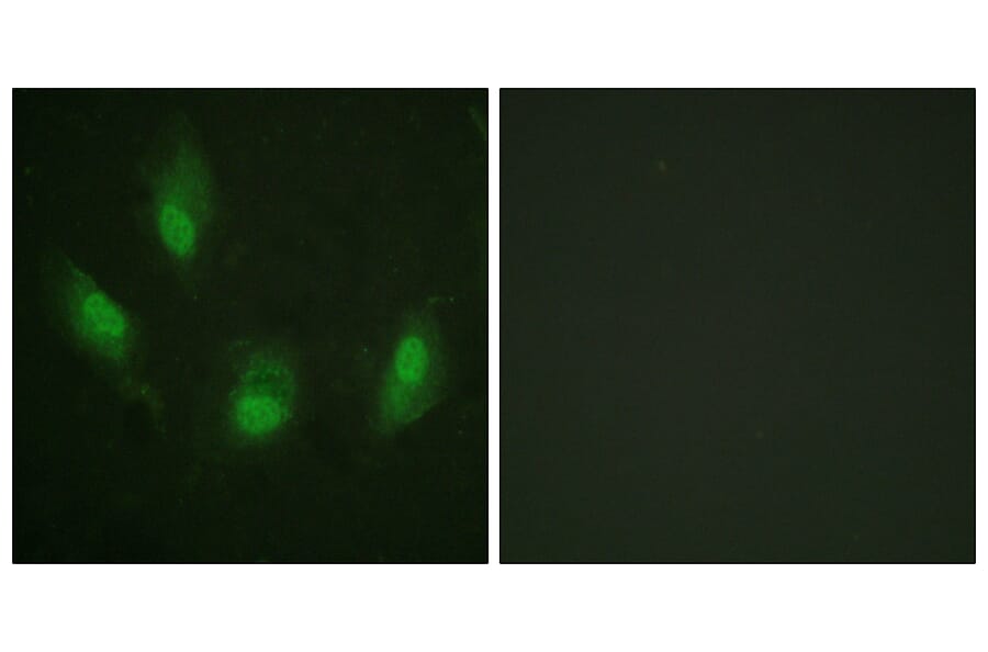Immunofluorescence - Anti-p53 Antibody (B0530) - Antibodies.com