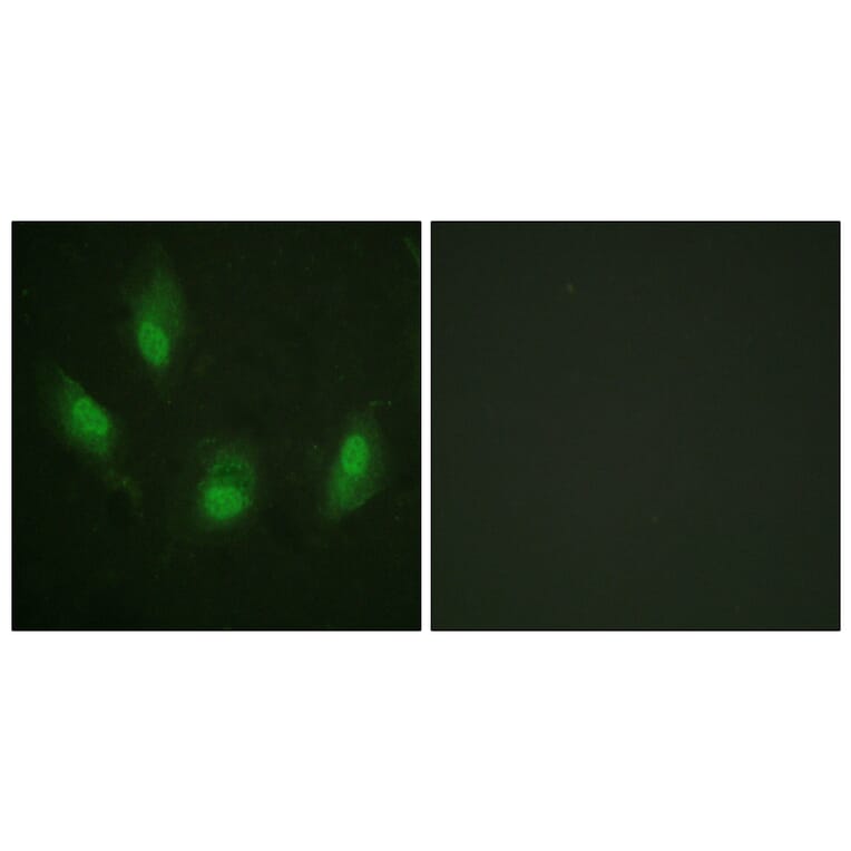 Immunofluorescence - Anti-p53 Antibody (B0530) - Antibodies.com