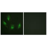 Immunofluorescence - Anti-p53 Antibody (B0530) - Antibodies.com