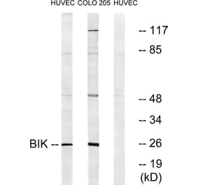 Western Blot - Anti-BIK Antibody (B0053) - Antibodies.com
