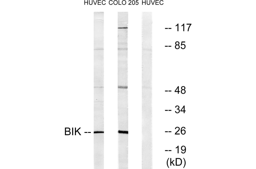Western Blot - Anti-BIK Antibody (B0053) - Antibodies.com