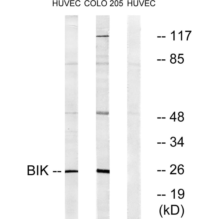 Western Blot - Anti-BIK Antibody (B0053) - Antibodies.com