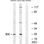 Western Blot - Anti-BIK Antibody (B0053) - Antibodies.com